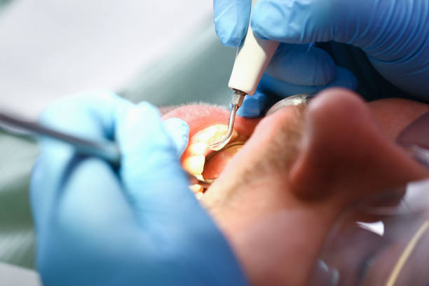 Best Emergency Tooth Extraction  in Coleman, TX